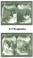 /album/reportagem-fotografica-sara/ecografia-jpg/